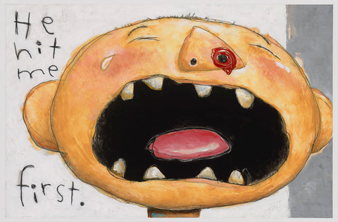 Grow Up, David! He Hit Me First